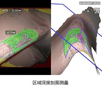 高清工業(yè)內(nèi)窺鏡MViQ HD區(qū)域深度剖面測量